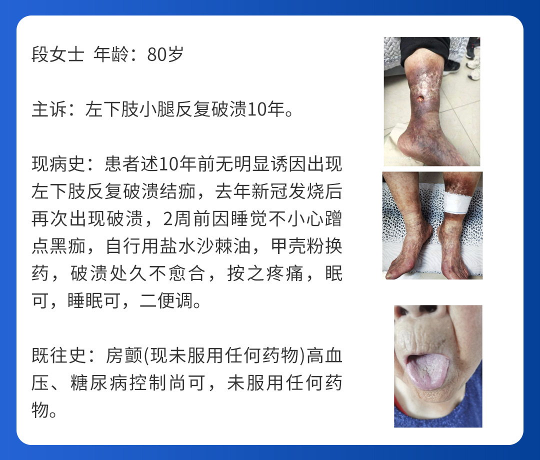 【北京市中西医结合乐动平台】第三期会诊(图6)